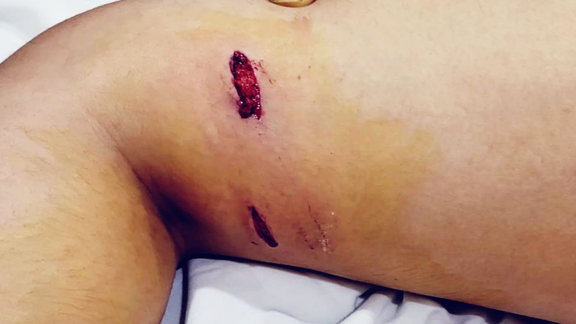 Dog bit a child in Sector-47 Noida owner will pay 10k rupee fine