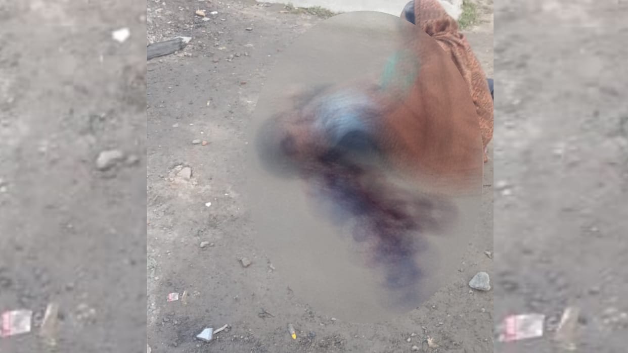 A dead body of a man forund in Indira Nagar Lucknow.
