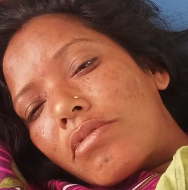 Six women injured in wasp attack