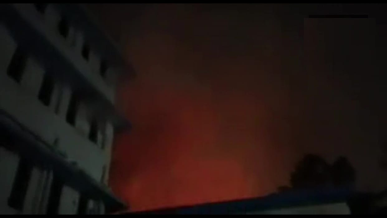 SSKM Hospital: Fire breaks out at Kolkata SSKM Hospital