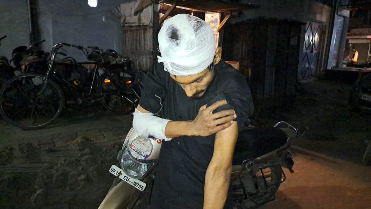 The crooks have attacked on Alim in Lisadigate of Meerut