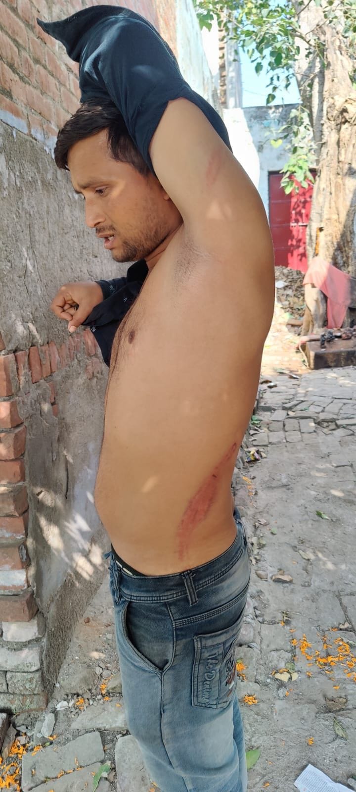 Etah: Police beat up the young man badly on the quarrel between the couple