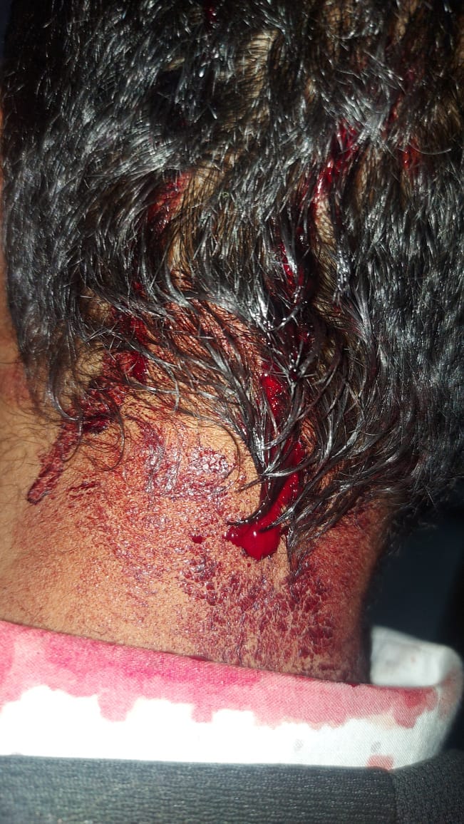 Hooliganism of people from outside states, three people were attacked in Hanogi