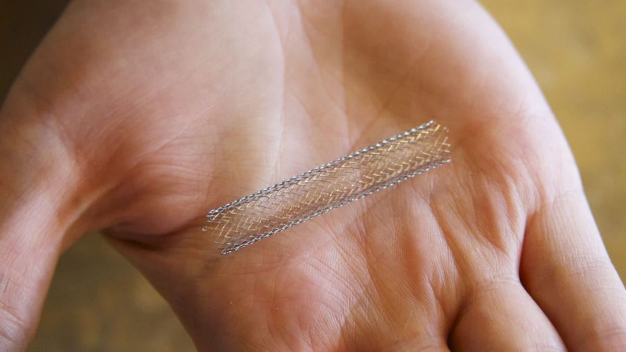 Health ministry includes coronary stents in National List of Essential Medicines 2022