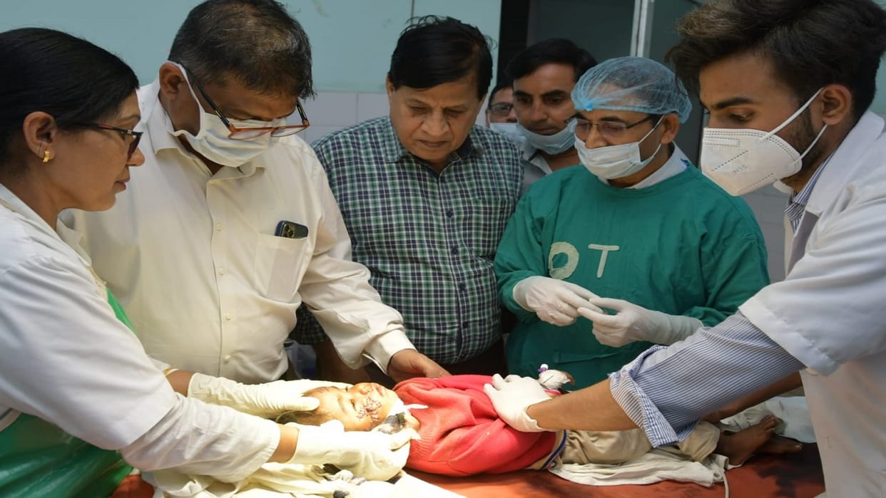 Dog Attack A one year old girl injured by dog in vijaynagar Ghaziabad got 115 stitches