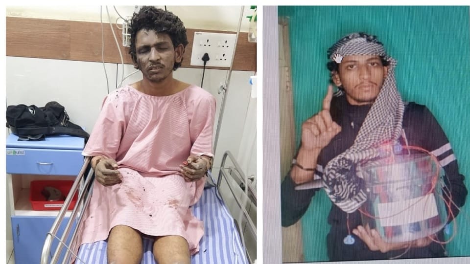 Cooker bomb blast accused shifted to Bengaluru
