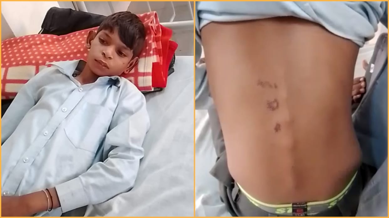 teacher beat student in Tonk boy backbone fractured