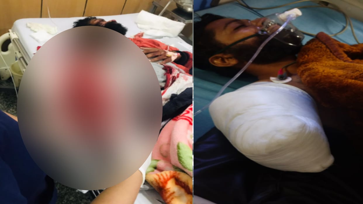 Meerut: Door of moving car opened, food delivery boy injured after being hit