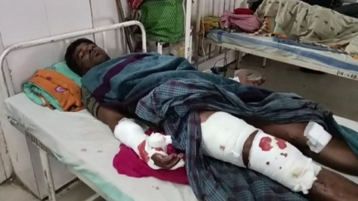 chhattisgarh bear attack; korba young man condition critical