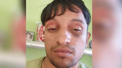 पीड़ित युवक