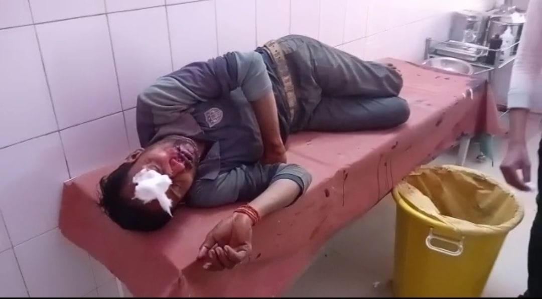 Chitrakoot: The team that went to investigate was attacked, the lineman injured