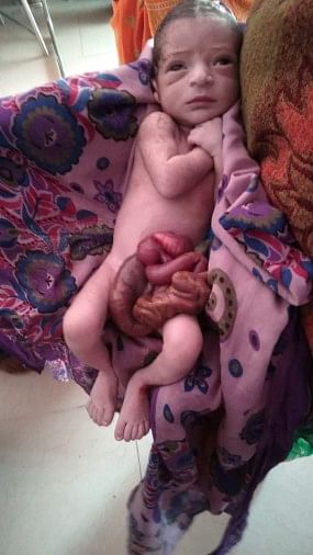 भनवापुर पीएचसी पर जन्मा बच्चा।