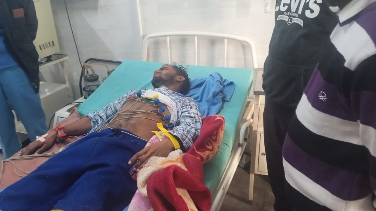 Condition of the employee injured while destroying firecrackers worsened