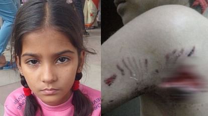 Ghaziabad Bapudham 10 year old girl Pet dog attack