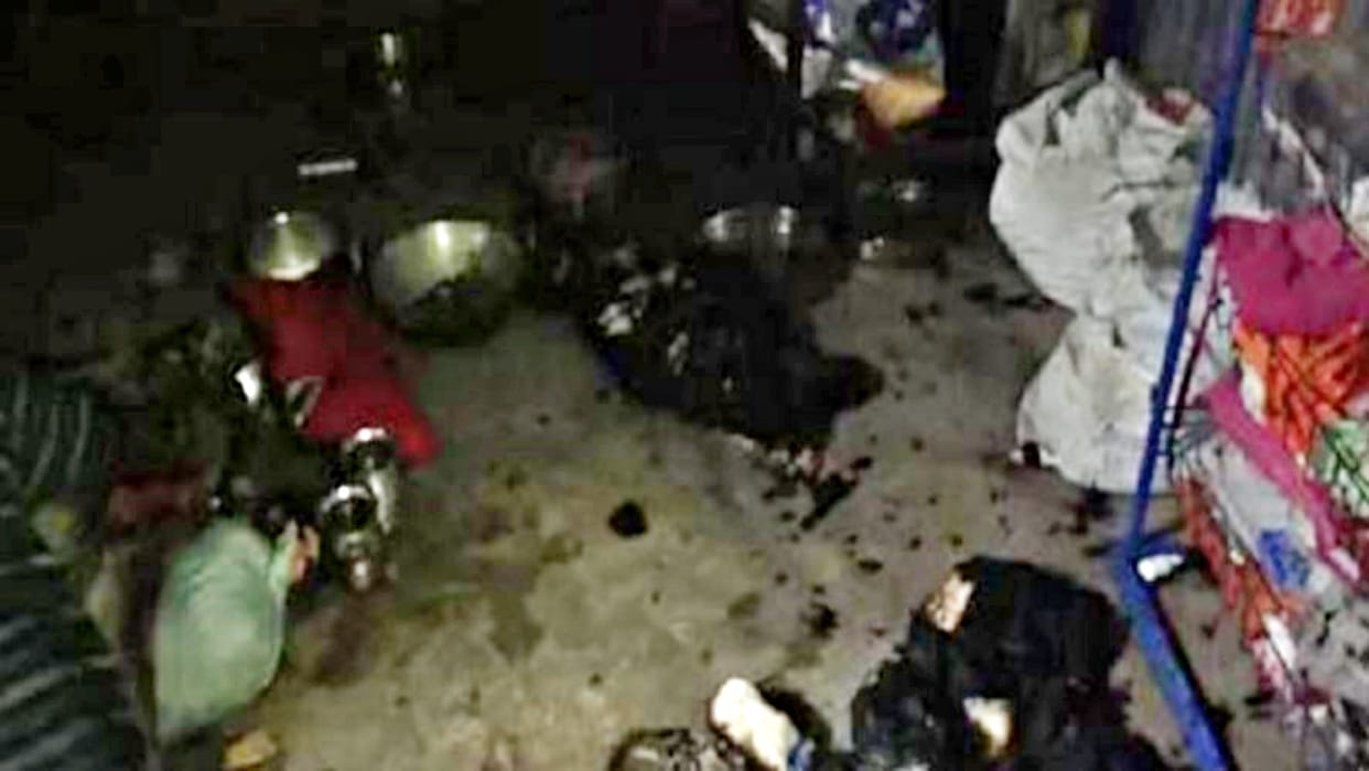 Rajasthan Scorched priest dies during treatment in petrol bomb attack