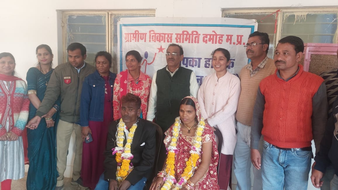MP News: Blind woman living in live-in became pregnant, childline got married to her partner