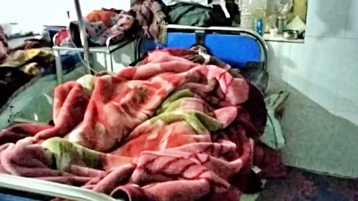 Newborn head separated from torso in cesarean delivery at Satna district hospital