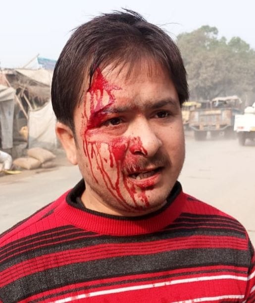 Hardoi, A bag full of money was looted from a bank friend in broad daylight