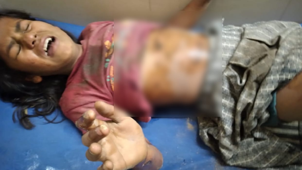 Three girls playing outside the house got scorched