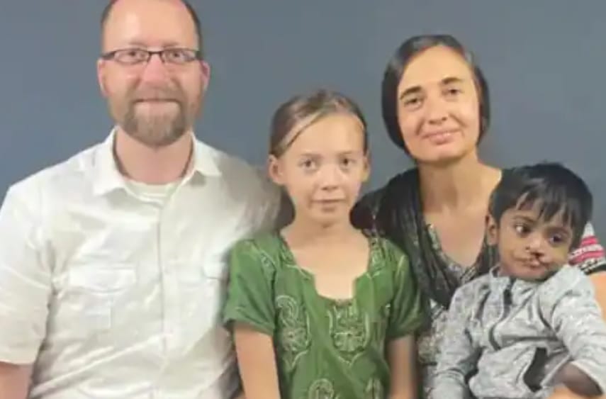 Lips damaged, dont have left wrist...Parents left the child in Patna, now American couple adopted