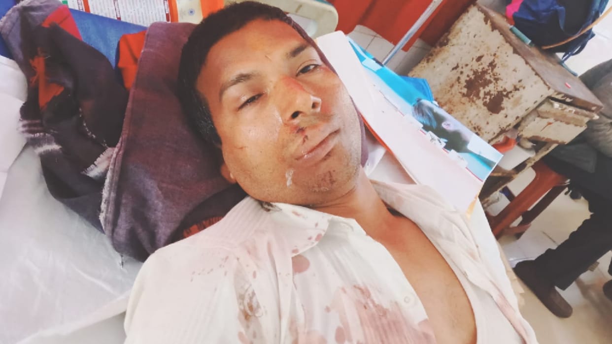 Case of shooting businessman police engaged in search of miscreants
