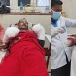 घायल हुए बदमाश।
