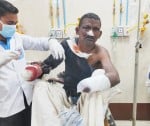 बाराबंकी के जहांगीराबाद थाना क्षेत्र के दतौली गांव में विस्फोट में हाथ गवाने वाला बदमाश शिव कैल?