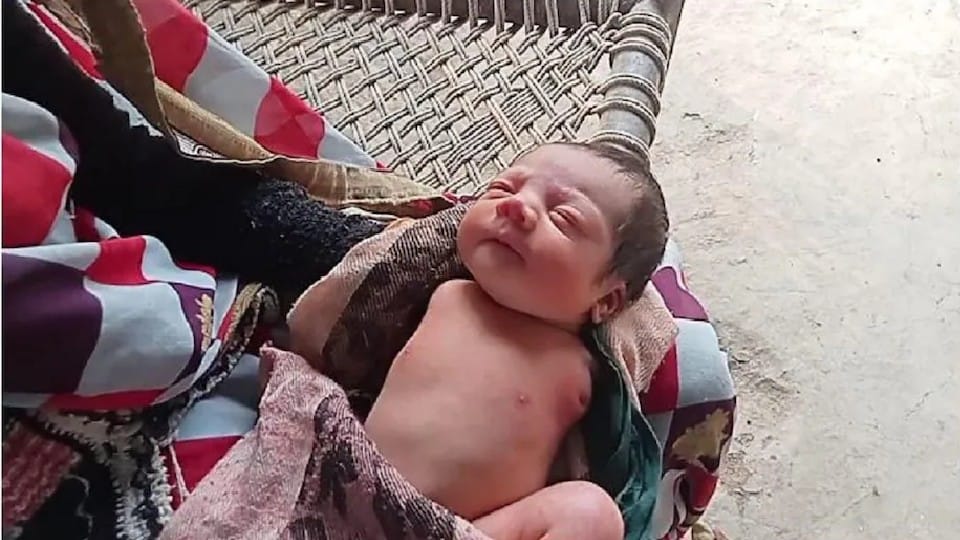 MP News: A child born without hands in Barwani