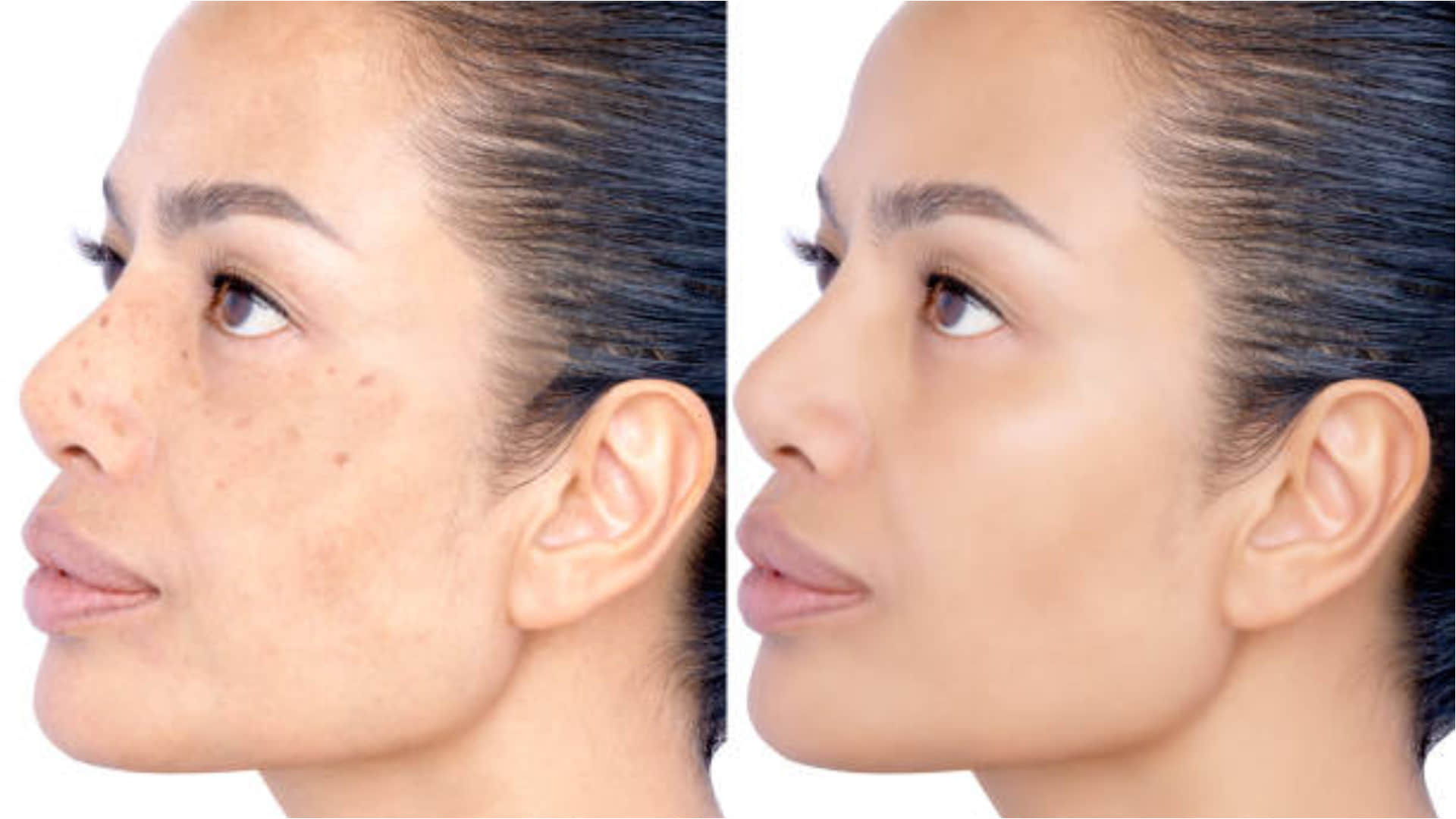 Apply Almond Oil Before Sleeping At Night To Remove Wrinkles and Black Spots Badam Tel Ke Fayde In Hindi