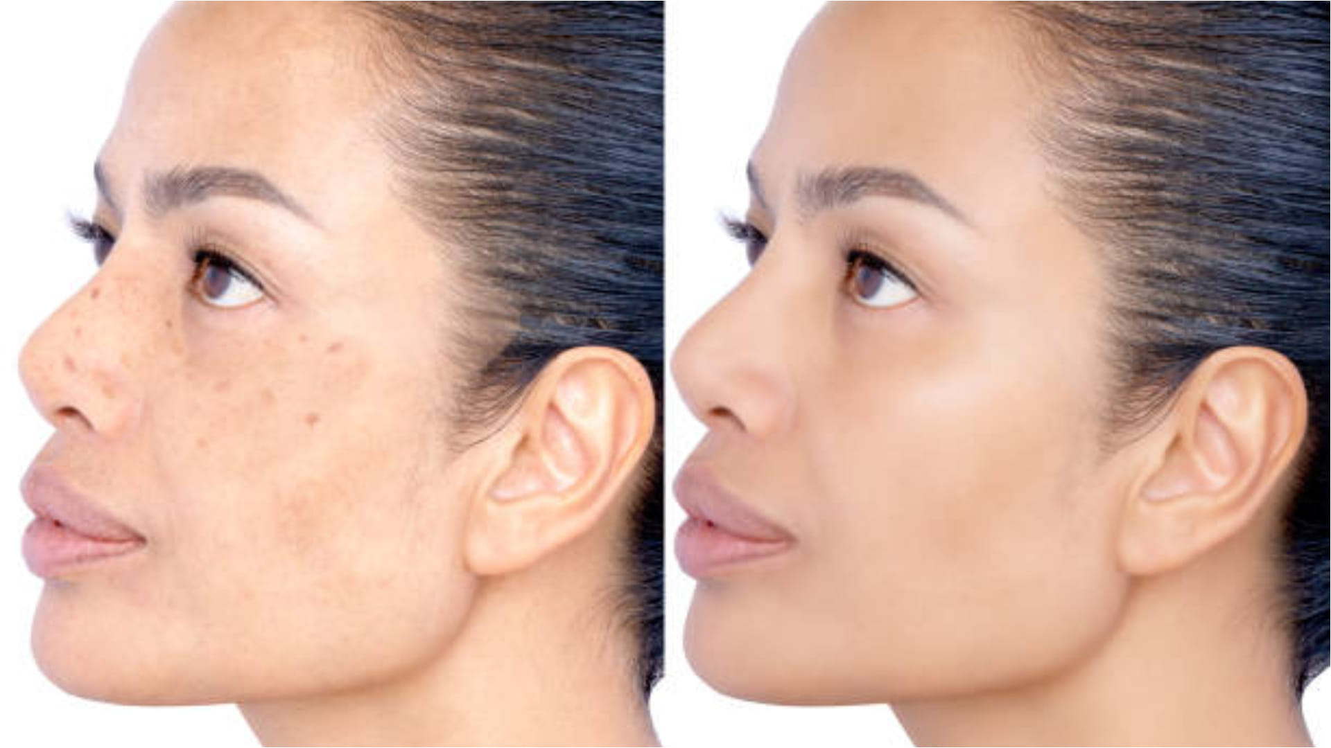 Apply Almond Oil Before Sleeping At Night To Remove Wrinkles and Black Spots Badam Tel Ke Fayde In Hindi