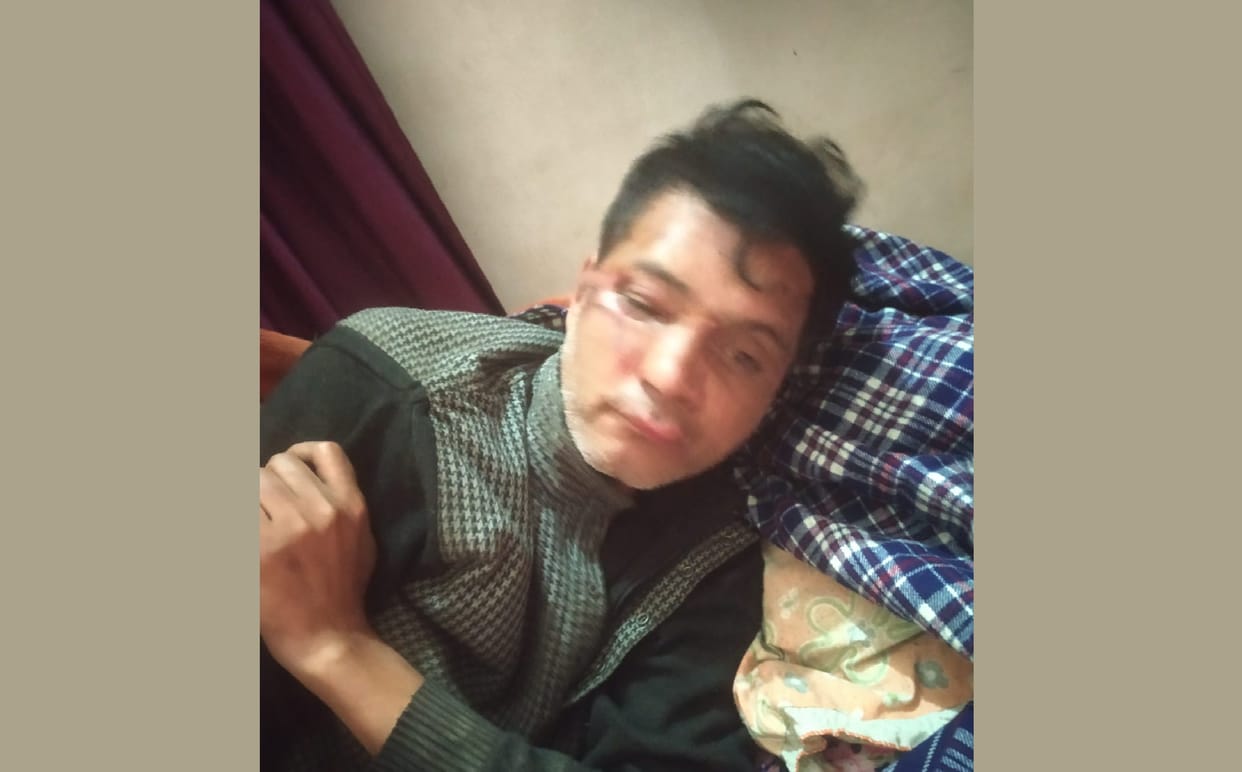 Auto riding miscreants robbed the bank manager in kanpur