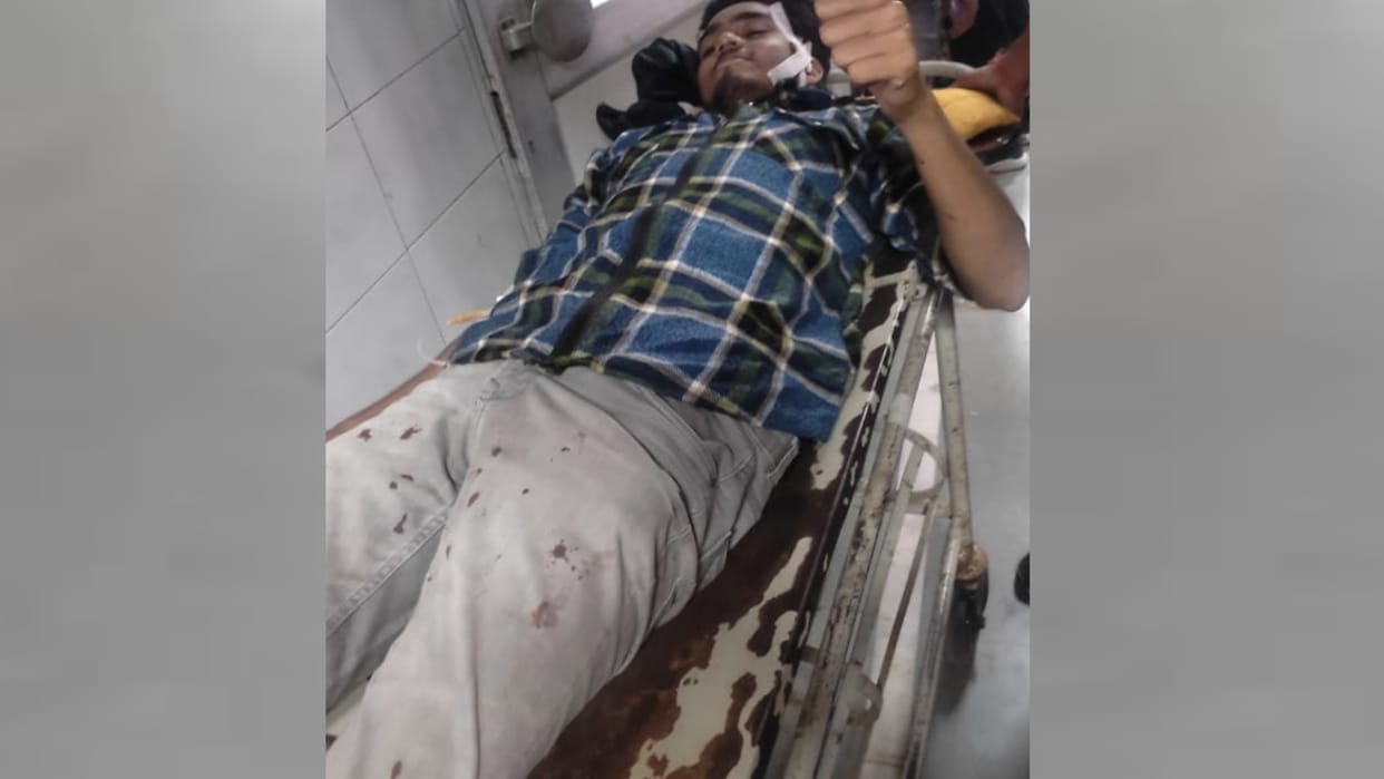 one student got injured in a clash in Lucknow University.