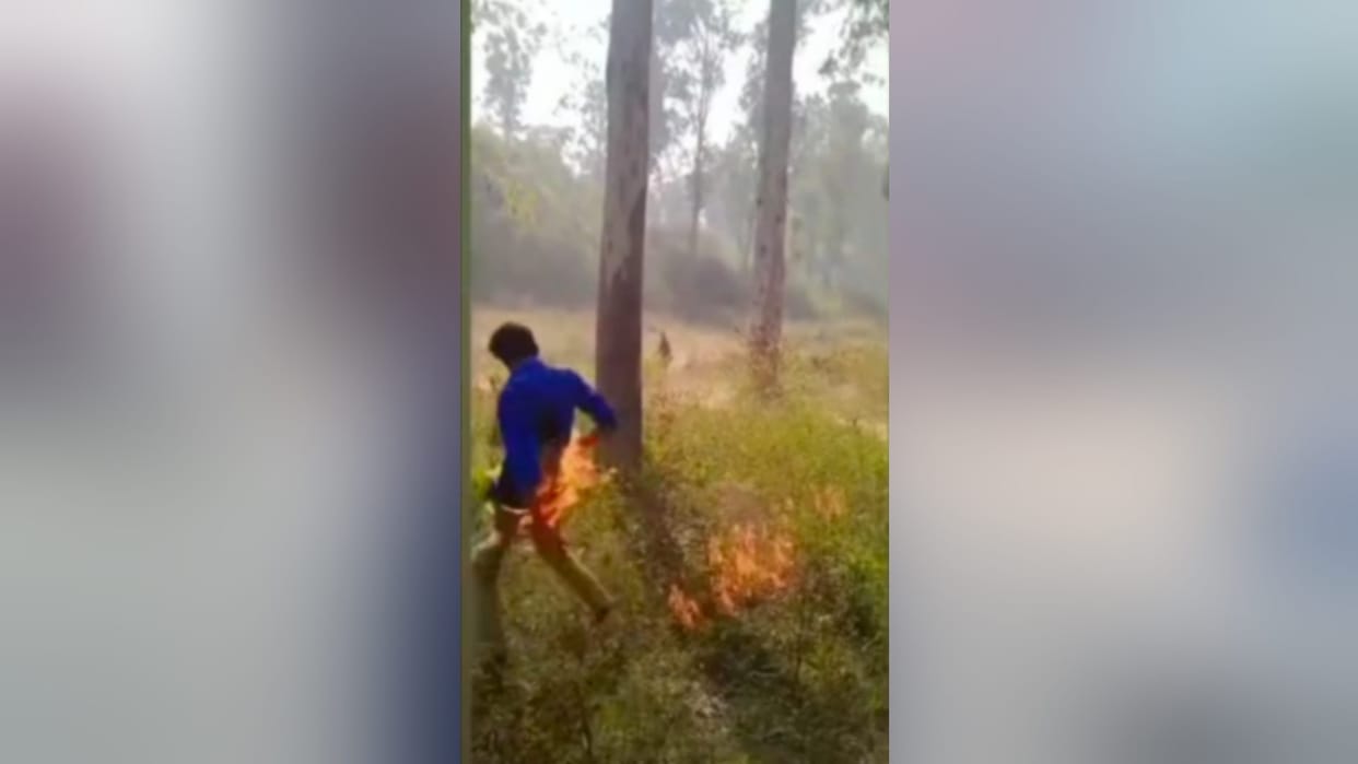 Bijnor: School student burnt while stunting with petrol bomb and see photos