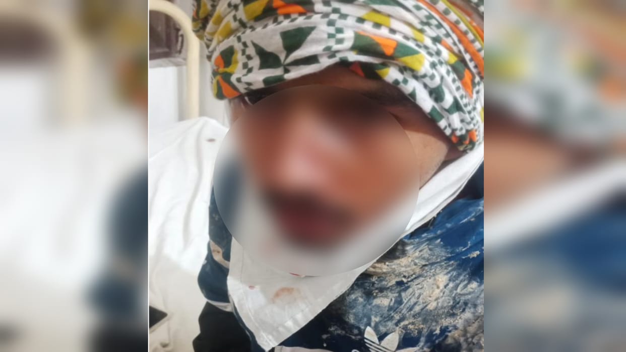 BAGHPAT: Student returning from a friends birthday was attacked with a sharp weapon