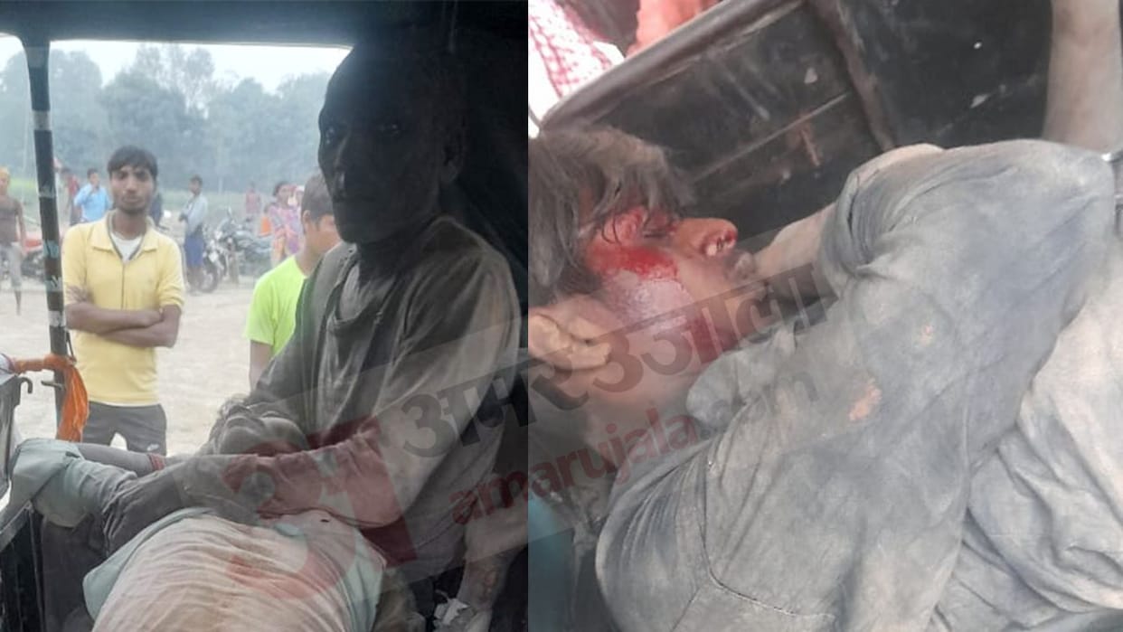 Big accident in Katihar's Pothia: Brick kiln chimney barrel fell down, 10 injured, many from UP
