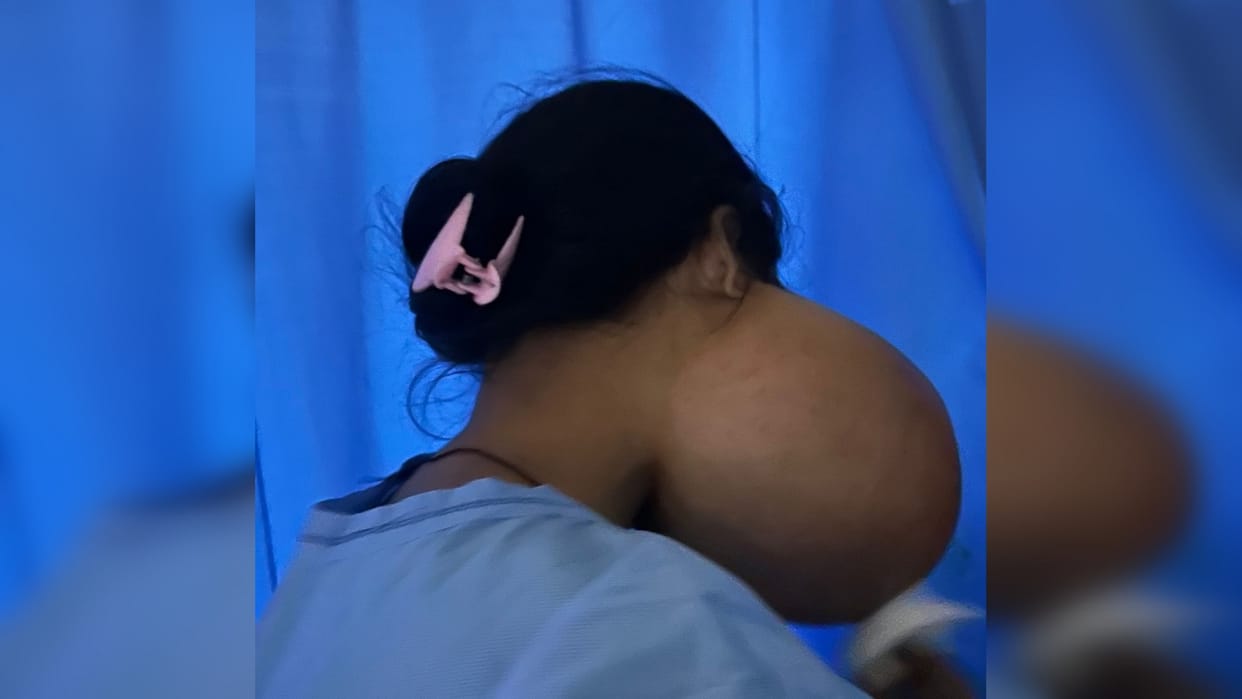 Do not ignore the swelling in jaw it may be ameloblastoma