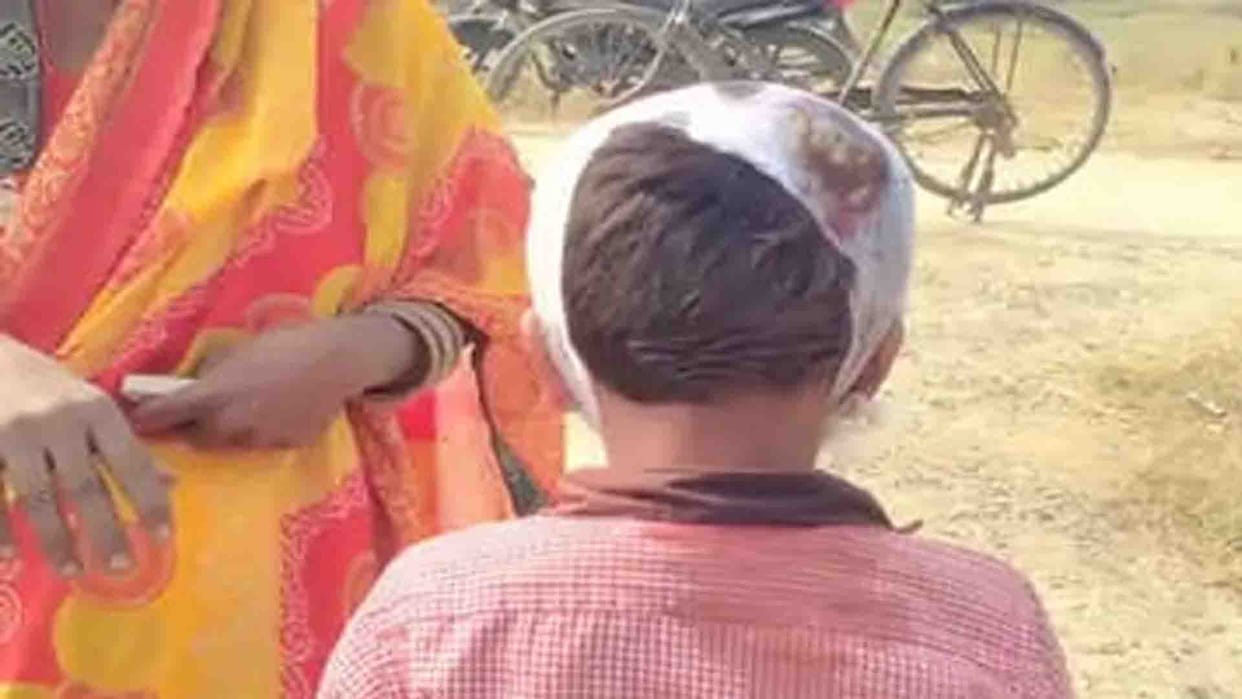 Unnao: Teacher accused of beating