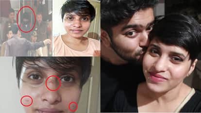 Shraddha Murder Case Shraddha not tell doctors about beating Delhi Police revealing after return from Mumbai