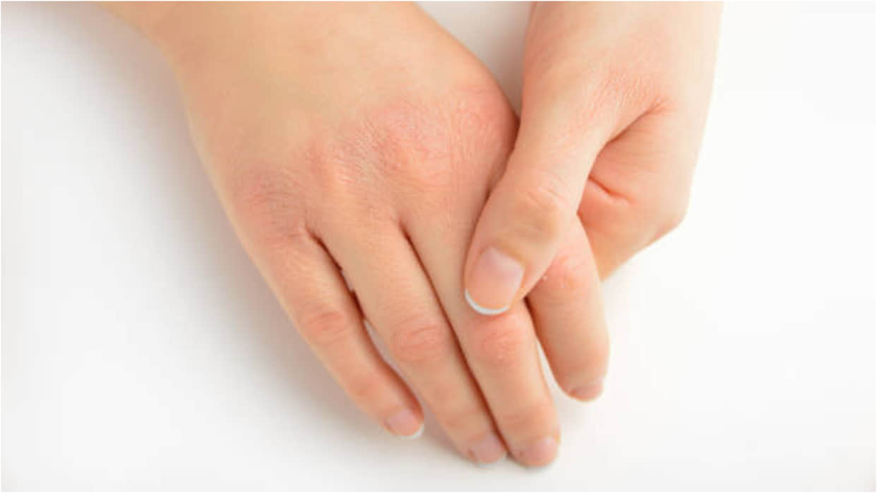 Winter Skin Care Tips Home Remedies For Dry Hands Ke Gharelu Upay In Hindi