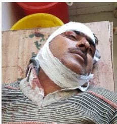 Hathras: Lawyer was taken in a car, beaten, chain and purse looted