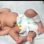 ग्वालियर में चार पैरों वाली बच्ची ने जन्म लिया है।