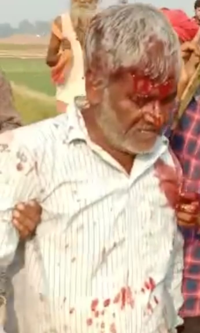 Leopard attacked farmers in Maharajganj, injured six