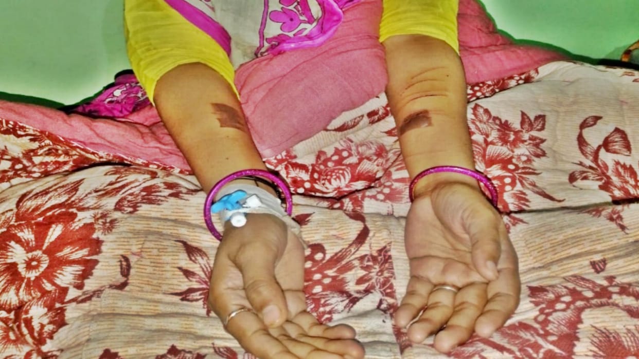 Rajasthan Daughter-in-law beaten with tongs for dowry in Hanumangarh miscarriage caused by beating on brother-