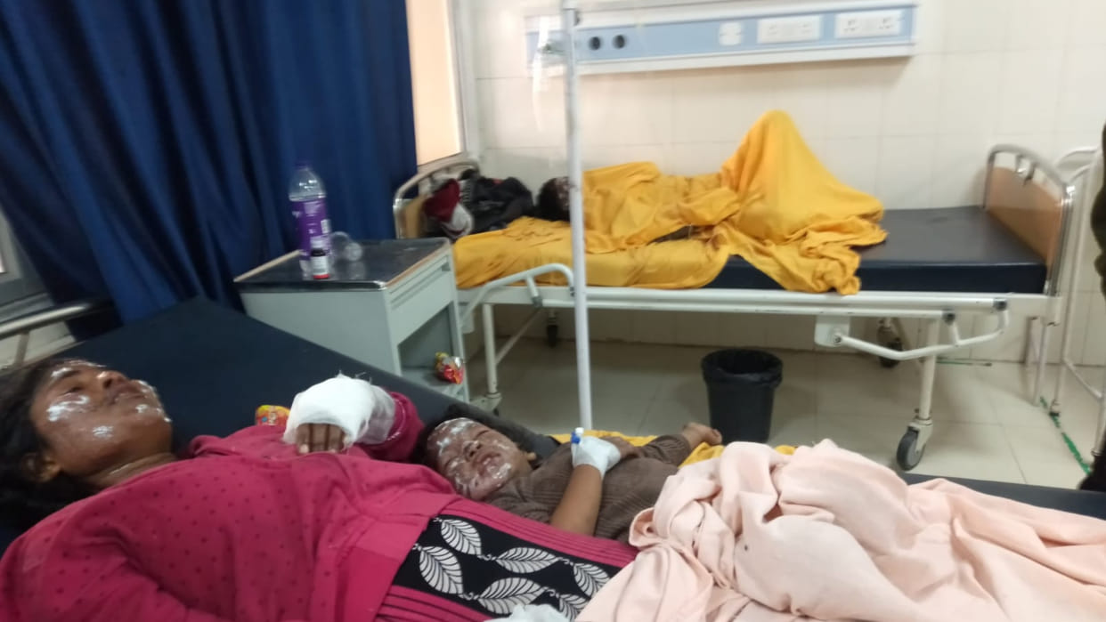 Fire broke out due to gas leak in Shiv Colony of Hisar, five people got scorched