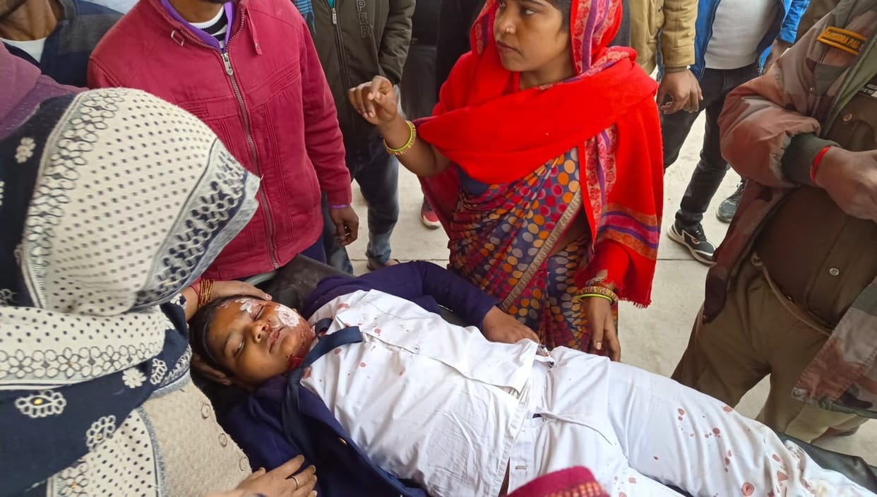 Mainpuri: Injured kept on suffering, first aid not received at CHC