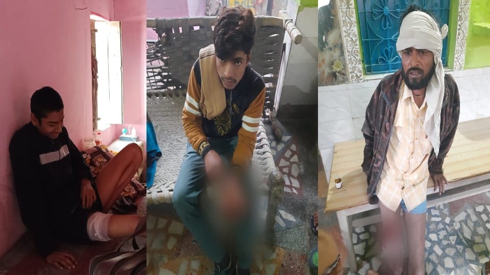 Dog bite injured 28 people including woman constable in Agra