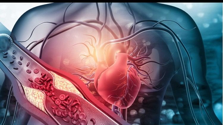 Vegetarian diet reduces  Blockage of Arteries and heart disease death risk know why plant based diet is better