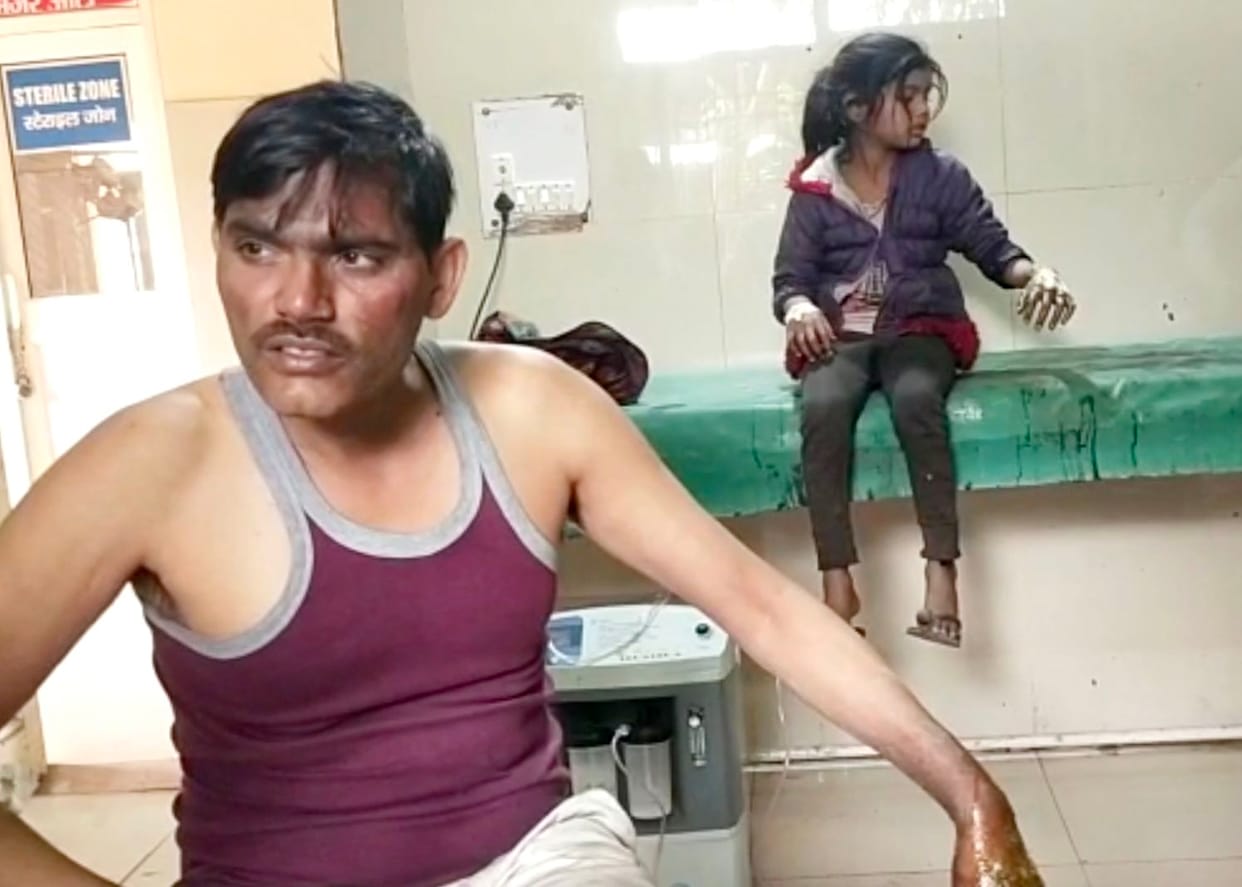 Firozabad: Earthen lamp caught fire in the house, three people got scorched