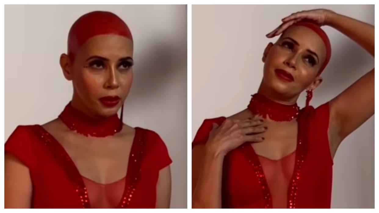 Rozlyn Khan Diagnosed with Cancer Savita Bhabhi Fame Actress Shares Her Bald Look Wishes Merry Christmas