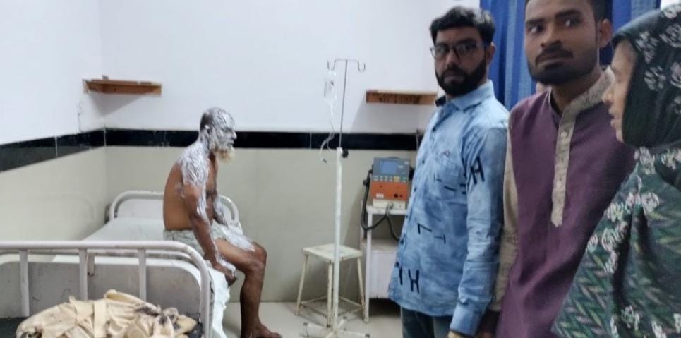 Sehore News: Two brothers clashed in a family dispute, one threw acid on the other